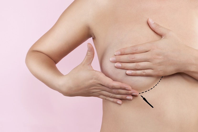 Câncer de mama: sintomas, causas e tratamentos